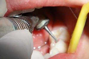 北上補牙系咪方便？