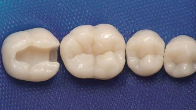 北上補牙系唔系安全?