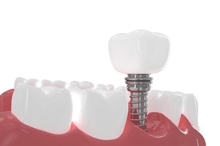 北上種植牙診所有冇幫忙訂酒店?