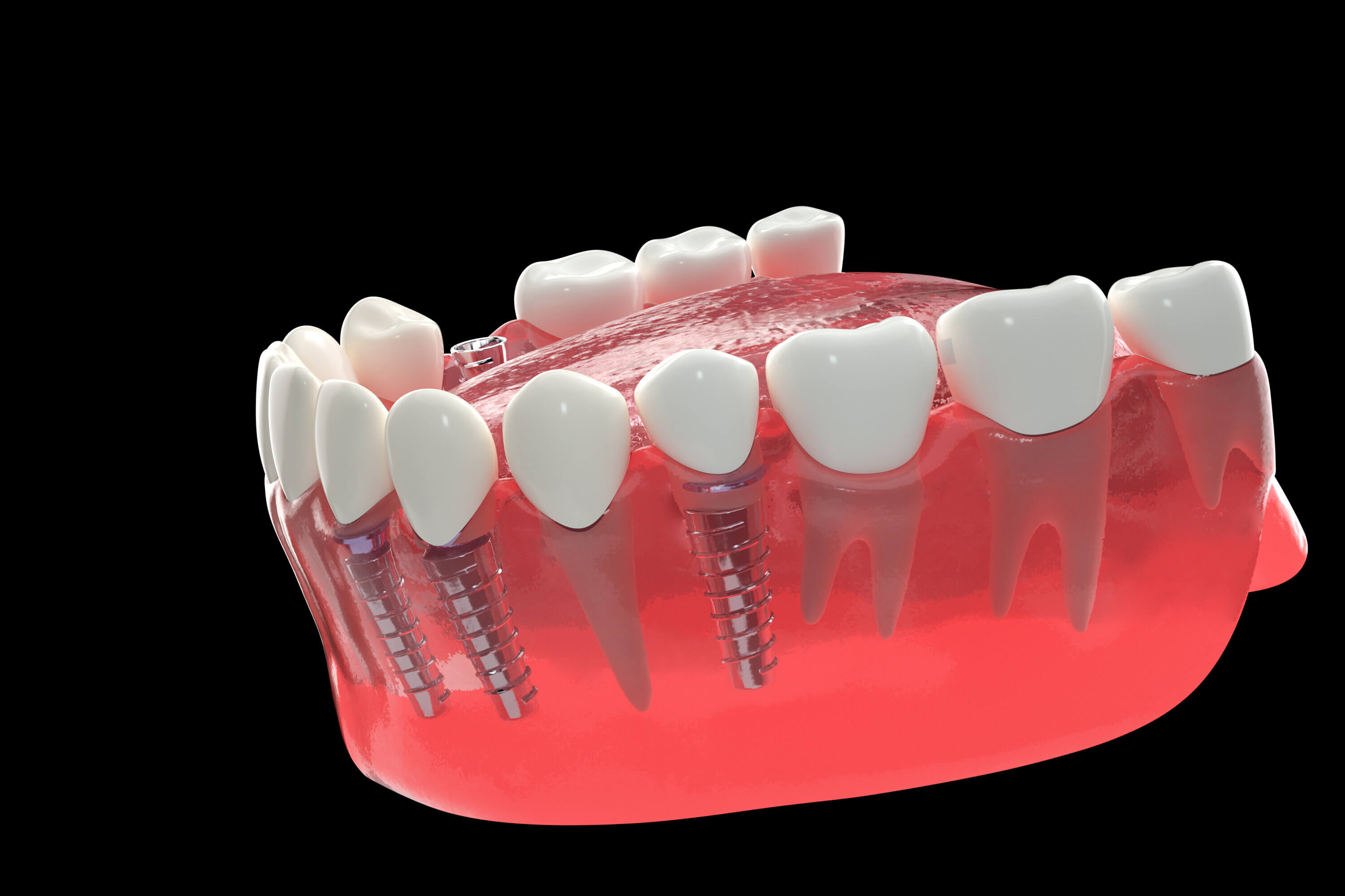 北上種植牙診所有冇提供X光檢查?