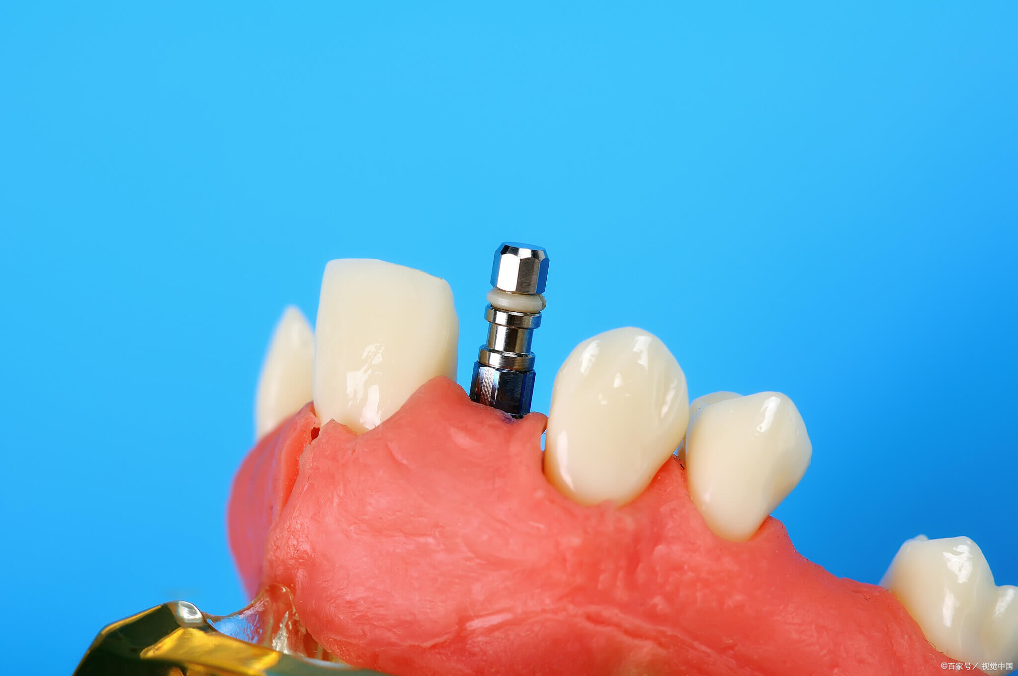 北上種牙邊間診所環境最好?