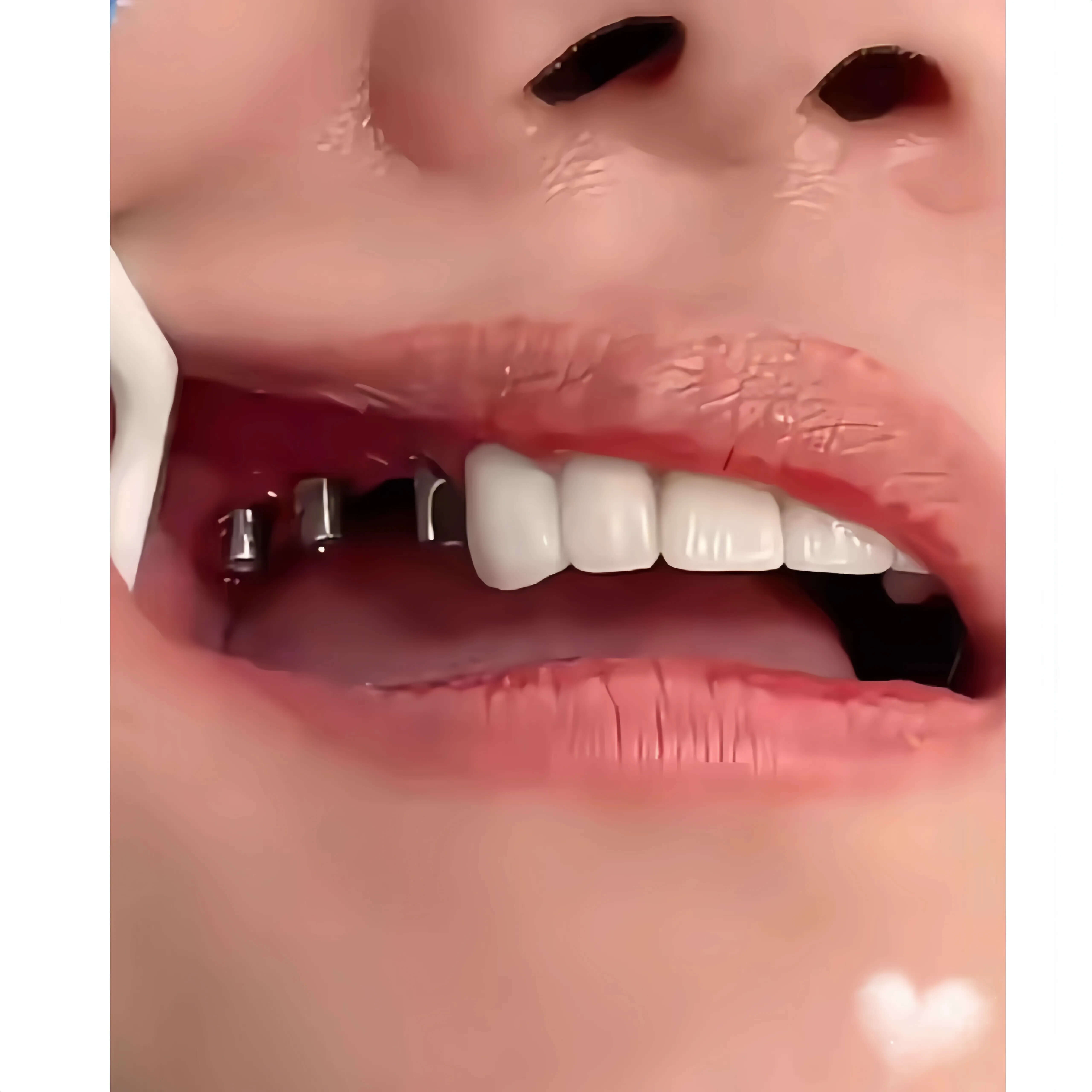 北上種牙係咪有免費檢查?