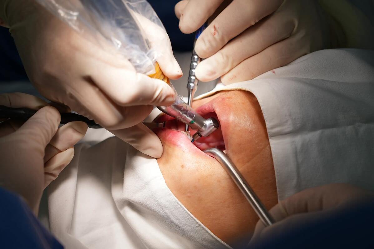 北上種植牙診所有冇冷光美白服務?