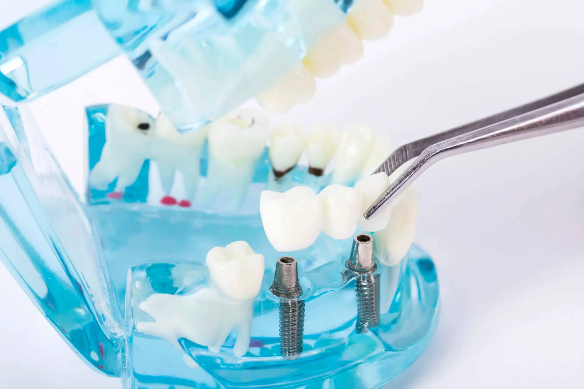 北上種植牙診所有冇正畸醫生團隊?