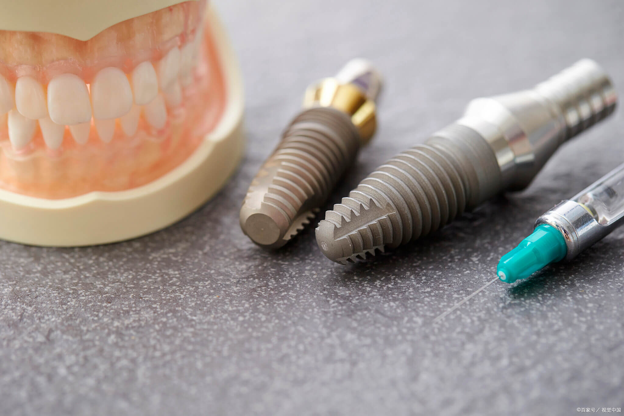 北上種牙後夜晚痛過日頭？原因係乜？