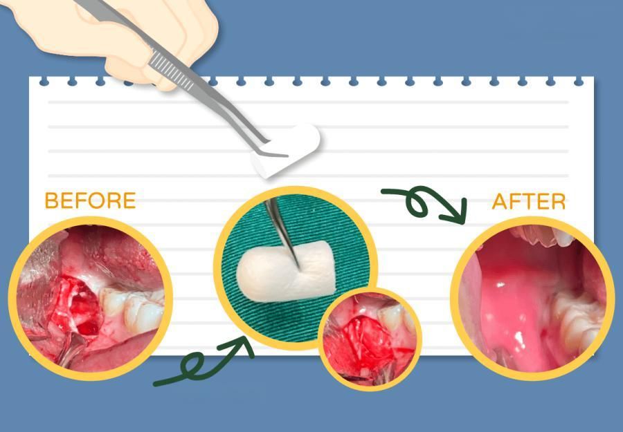 北上拔智齒術後可以講話嗎？