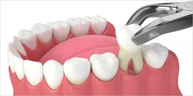 北上拔智齒診所設備先進嗎？