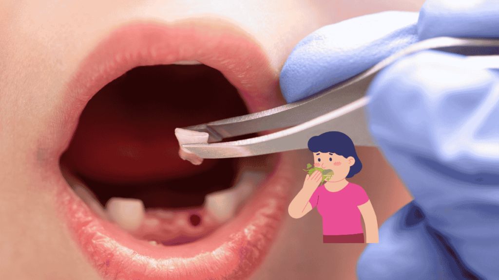 北上拔牙收費透明清楚嗎？