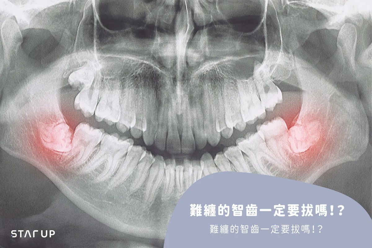 北上拔智齒北上流程複雜嗎？