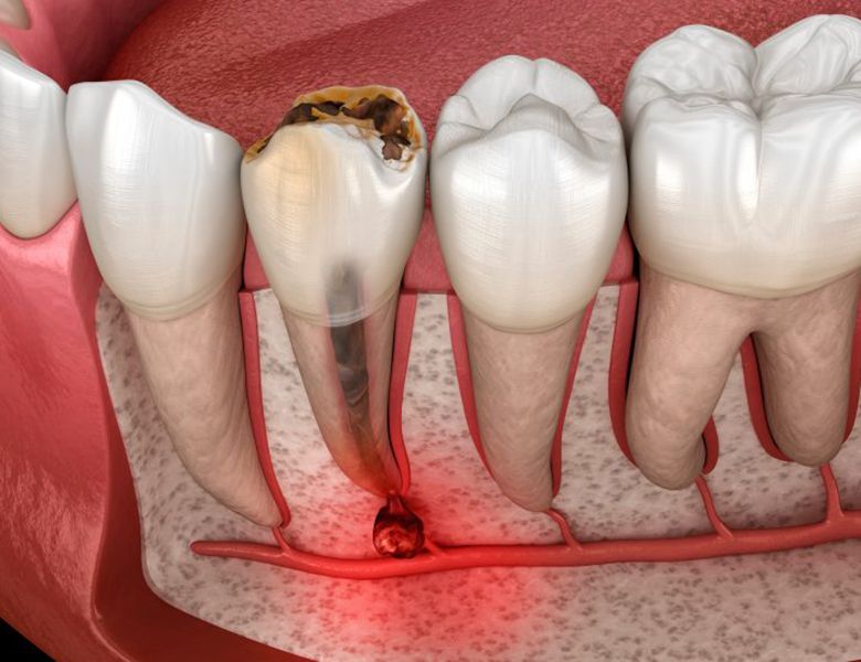 Can I go back to work immediately after going to Dagupan in Luzon