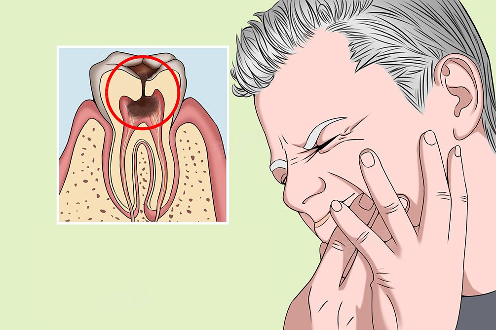 After a root canal treatment, will you feel fatigued