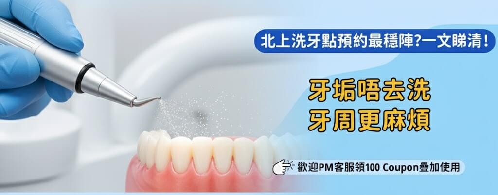 洗牙要預約嗎？北上牙科流程懶人包