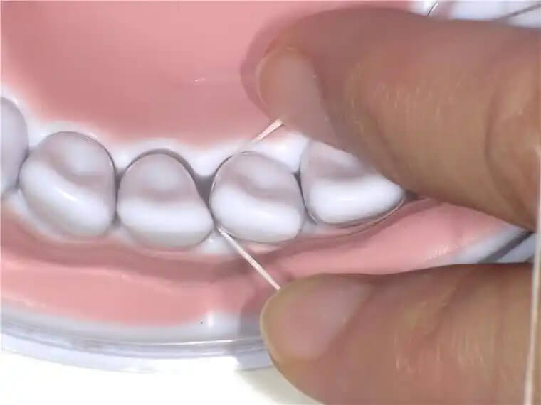 Essential Post-Cleaning Care Tips After Going to Mainland China for Dental Scaling