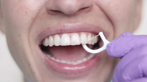 Teeth Cleaning in Mainland China vs Hong Kong Price and Effectiveness Comparison