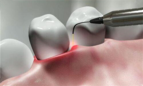 Best dental clinics worth visiting up north for teeth cleaning (scaling)