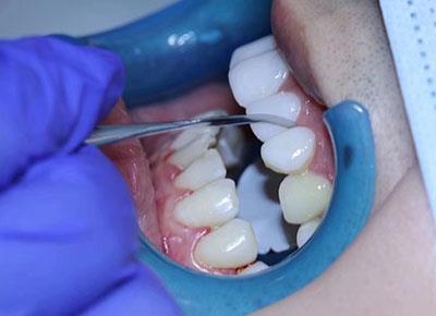 Is it convenient to travel north for a dental cleaning