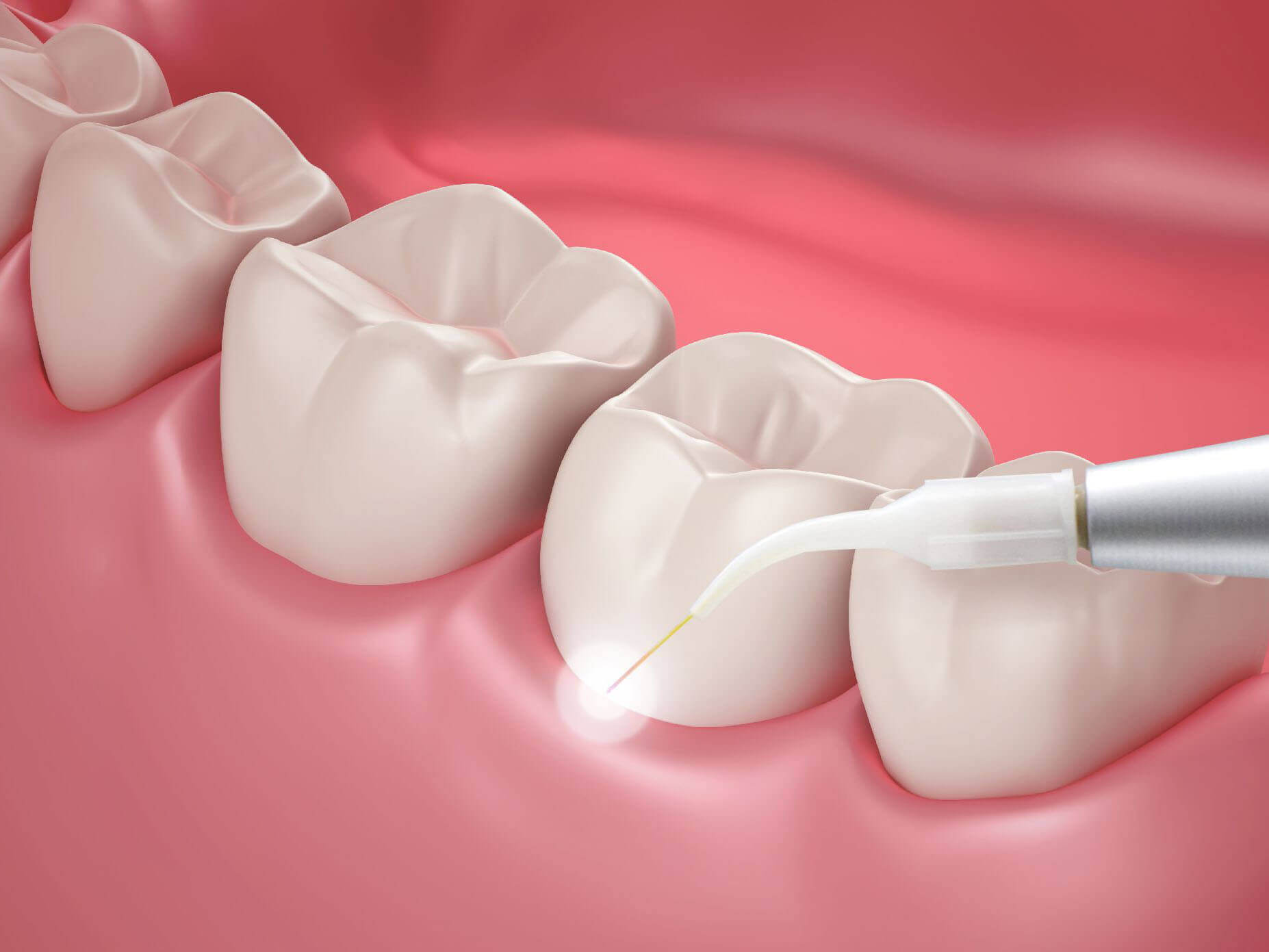 What to Know Before Getting a Teeth Cleaning in Mainland China