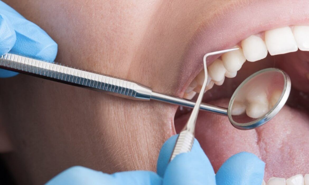 Smart Scheduling Tips for Teeth Cleaning When Heading North