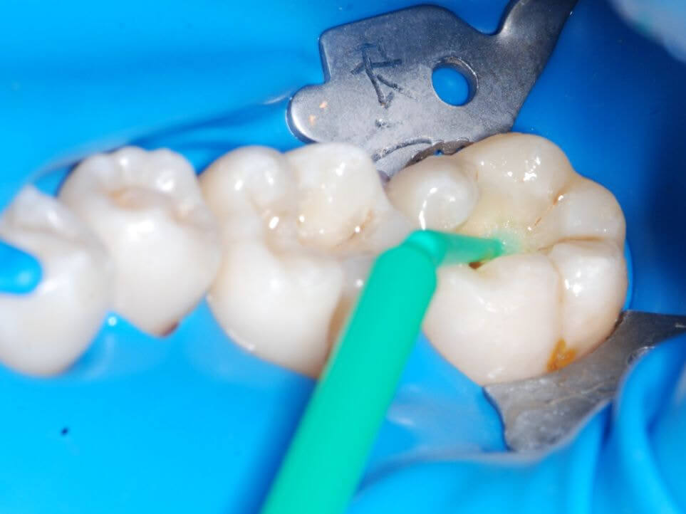 Getting Your Teeth Cleaned in Mainland China What to Watch Out For and How to Choose the Right Dental Clinic, According to a Dentist