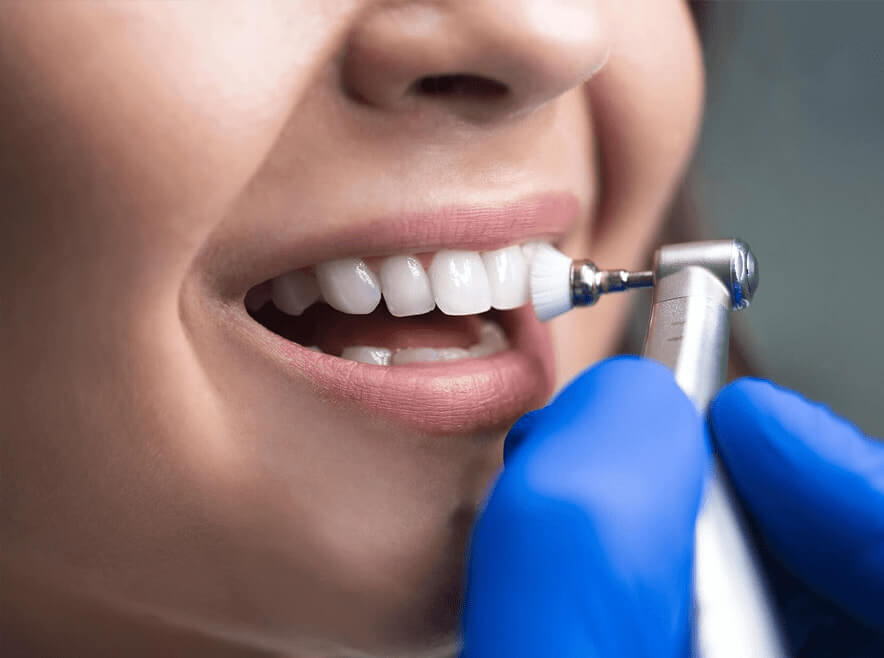 Safety Guide for Getting Your Teeth Cleaned in Mainland China