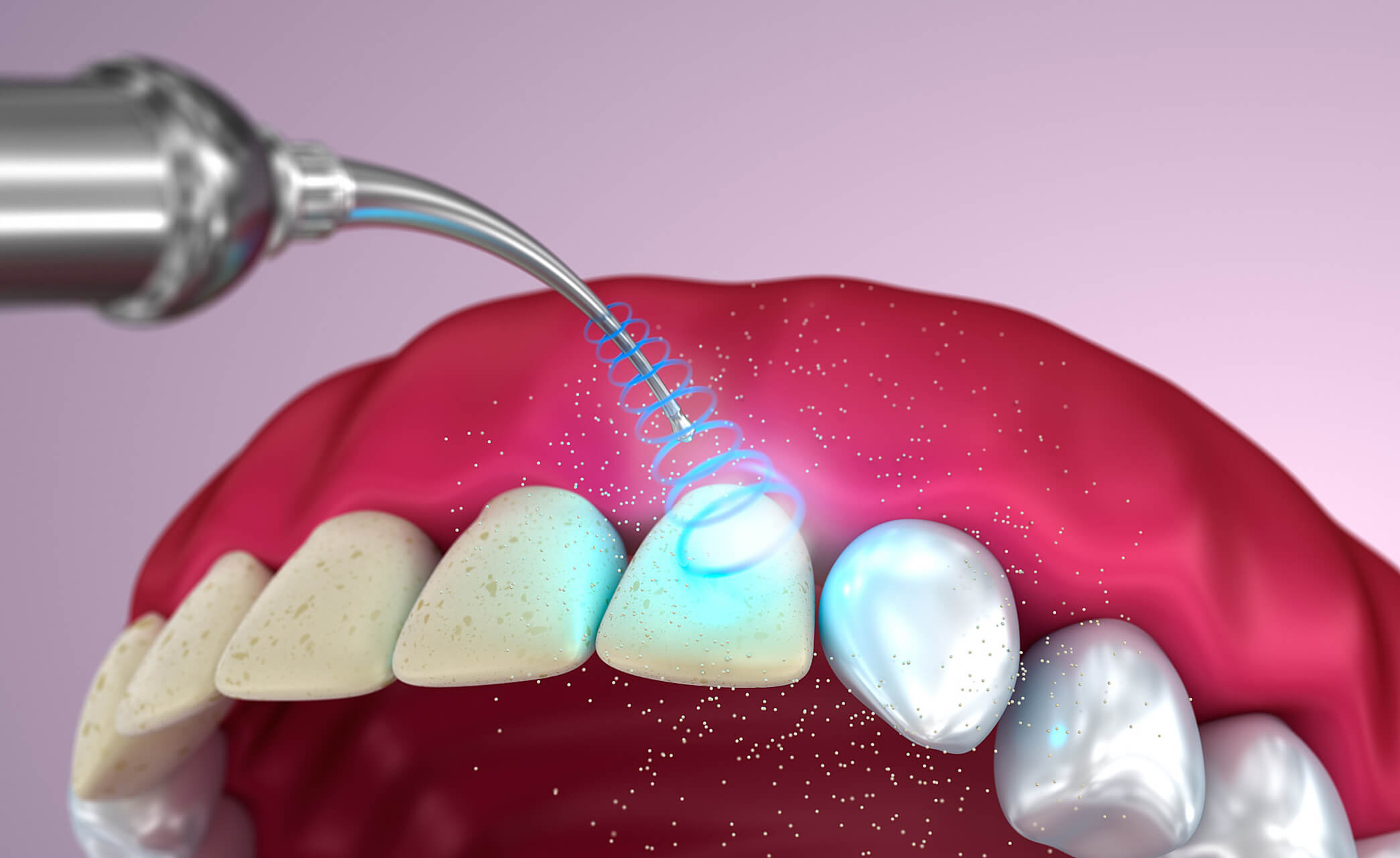 Does Beishang Dental Cleaning Clinic offer English-language services