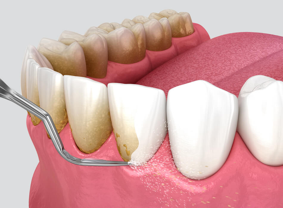 Money-Saving Guide to Getting Your Teeth Cleaned in Mainland China Look Great Without the High Price