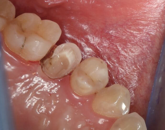 My Teeth Cleaning Experience in Mainland China Affordable, High-Quality Care and Excellent Service