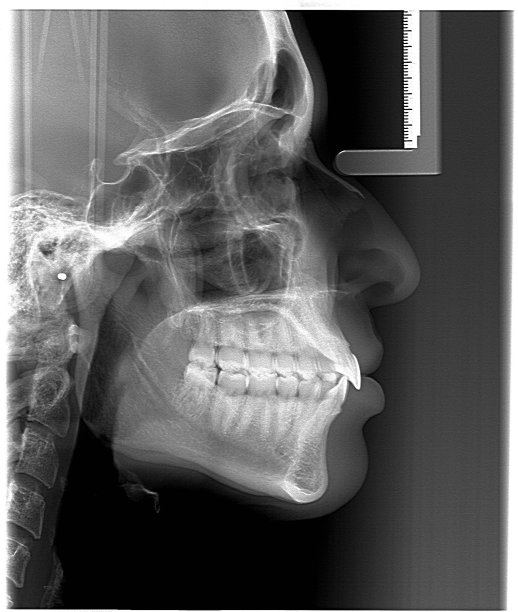 Understanding Periodontal Disease Its Impact on Oral Health and Systemic Conditions in Modern Society