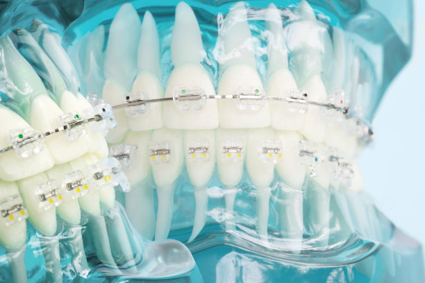 Exploring the Long-Term Benefits and Innovations of Dental Implants for Enhanced Oral Health and Aesthetic Improvements