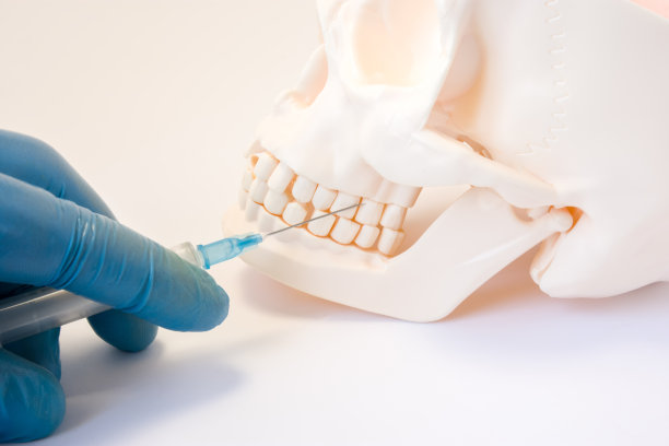 Revolutionizing Smiles The Impact of Dental Implants on Modern Dentistry and Patient Confidence