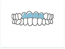 珠海牙齒矯正價錢