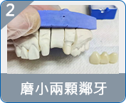 拱北全口重建邊度好