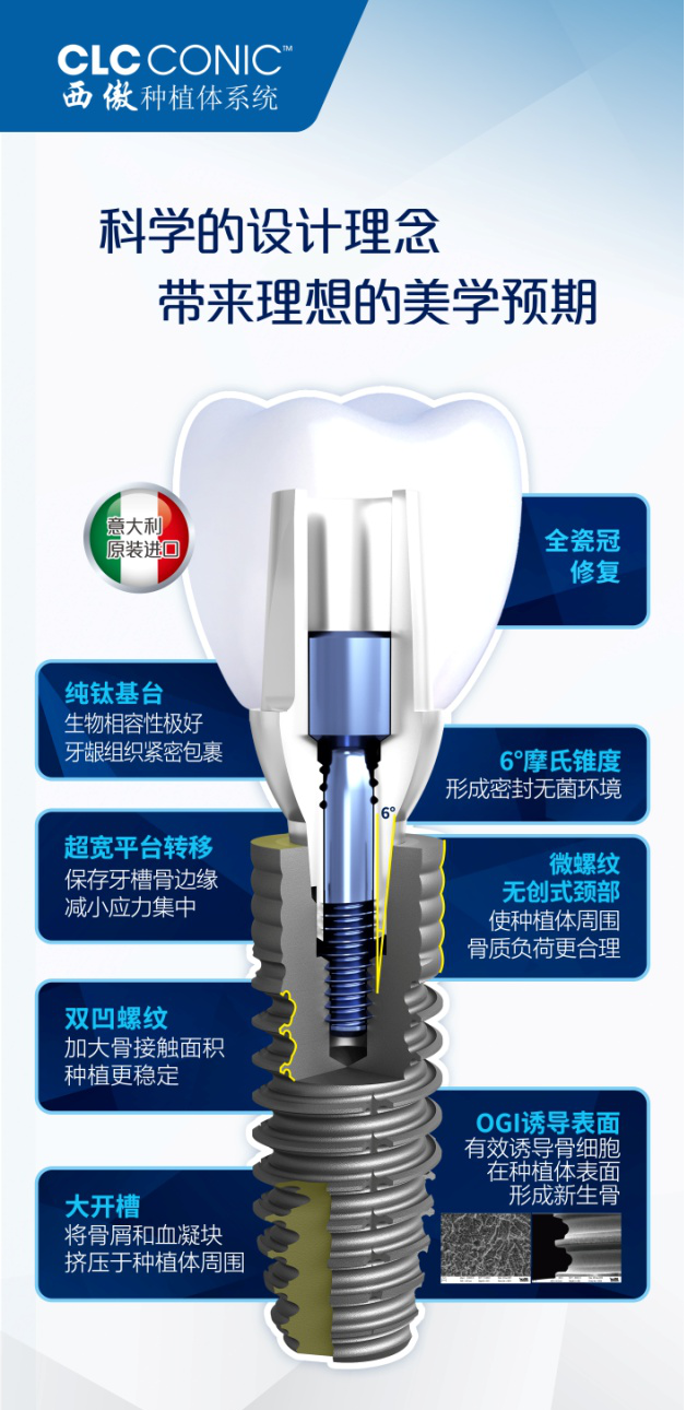 維港歡樂口腔引進意大利種植體